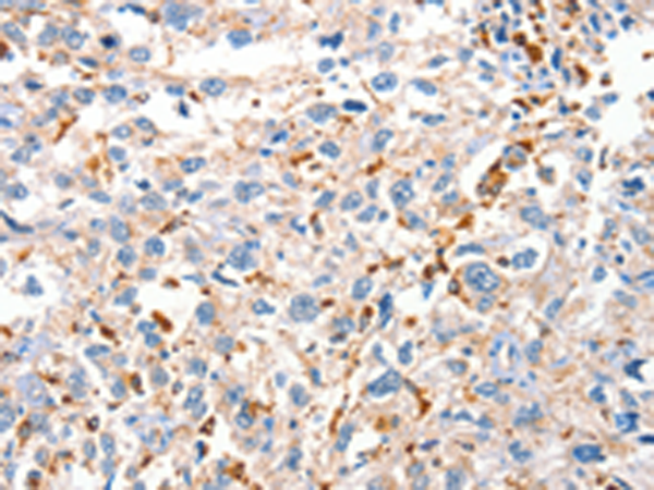 Rabbit Polyclonal Antibody to DUSP14