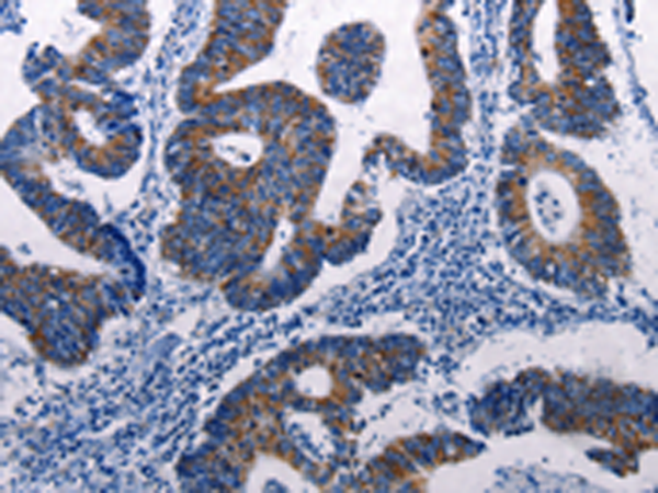 Rabbit Polyclonal Antibody to DUSP6