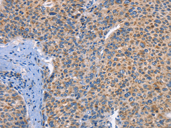 Rabbit Polyclonal Antibody to DUSP10