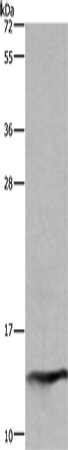 Rabbit Polyclonal Antibody to FABP2