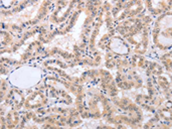 Rabbit Polyclonal Antibody to FADD