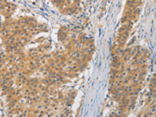Rabbit Polyclonal Antibody to FASTK