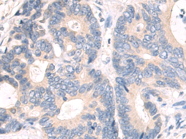 Rabbit Polyclonal Antibody to FGFR1