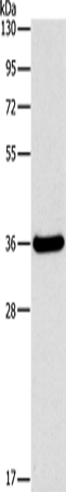 Rabbit Polyclonal Antibody to FGL1