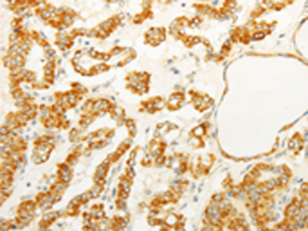 Rabbit Polyclonal Antibody to FOXR2