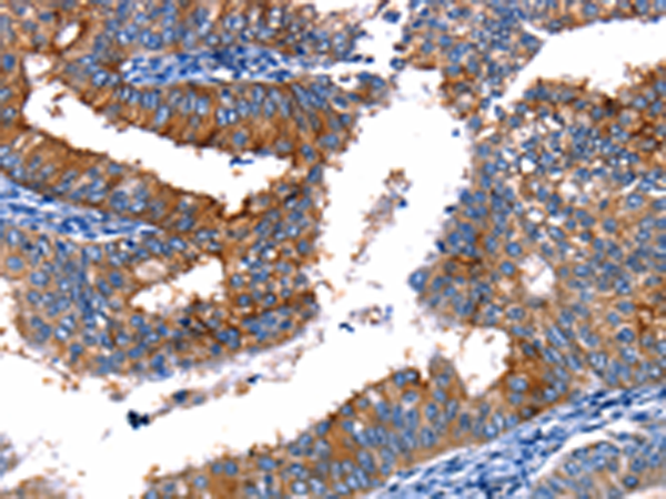 Rabbit Polyclonal Antibody to TBX22