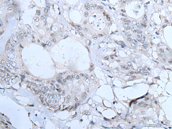 Rabbit Polyclonal Antibody to TBX6