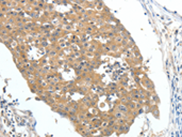 Rabbit Polyclonal Antibody to FSHR