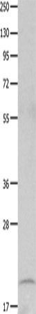 Rabbit Polyclonal Antibody to FHIT