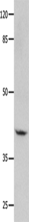 Rabbit Polyclonal Antibody to GNA11