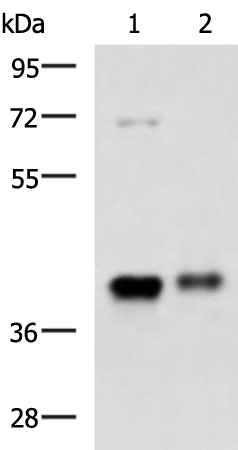 Rabbit Polyclonal Antibody to GNAZ