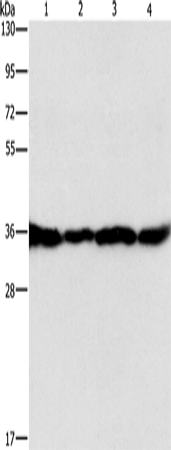 Rabbit Polyclonal Antibody to GNB1