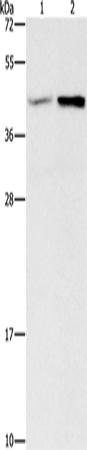 Rabbit Polyclonal Antibody to GNB5