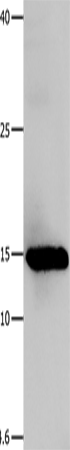 Rabbit Polyclonal Antibody to LGALS1