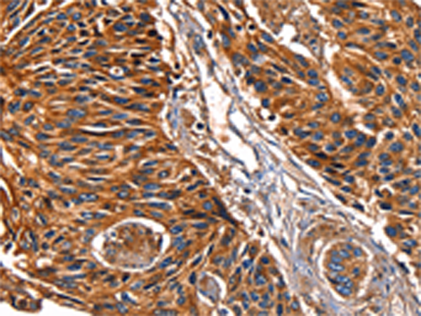 Rabbit Polyclonal Antibody to LGALS8