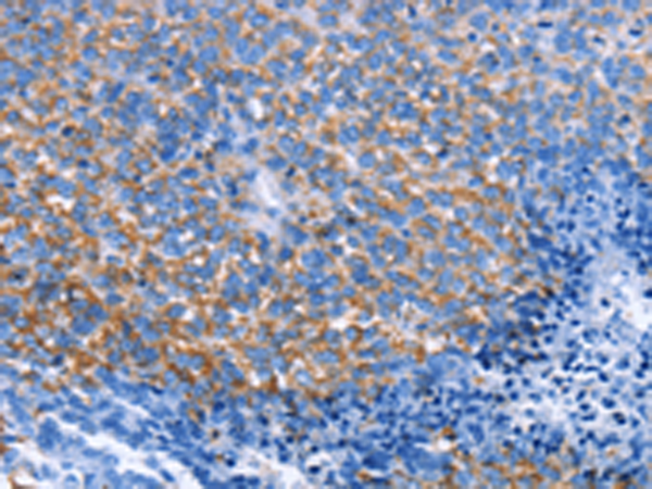 Rabbit Polyclonal Antibody to CXCL3