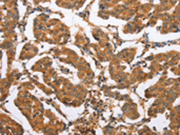Rabbit Polyclonal Antibody to CXCL14