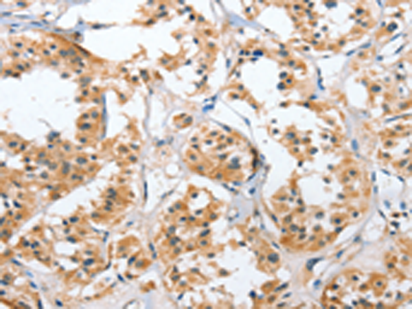 Rabbit Polyclonal Antibody to UGCG
