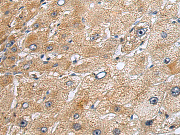 Rabbit Polyclonal Antibody to GDF15