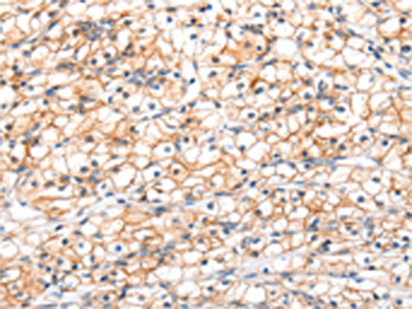Rabbit Polyclonal Antibody to GLP1R