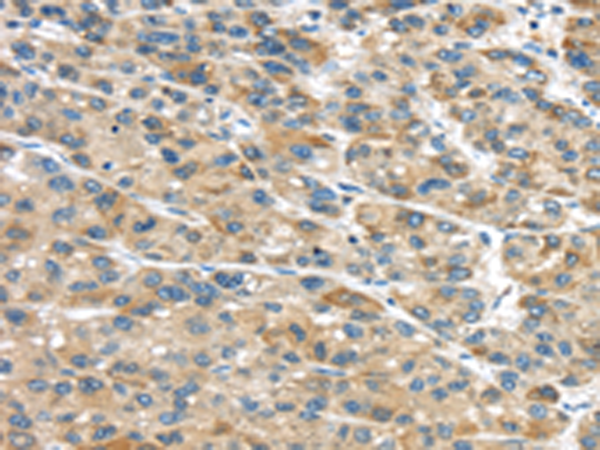 Rabbit Polyclonal Antibody to GLP2R