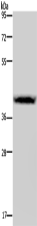 Rabbit Polyclonal Antibody to CSF2RA