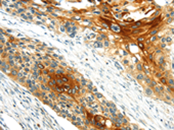 Rabbit Polyclonal Antibody to GRB2