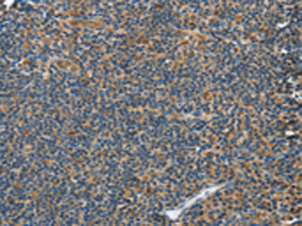 Rabbit Polyclonal Antibody to GRB7