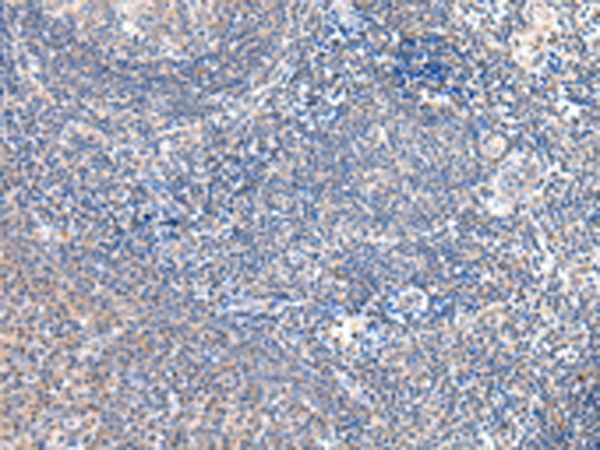 Rabbit Polyclonal Antibody to GRB14