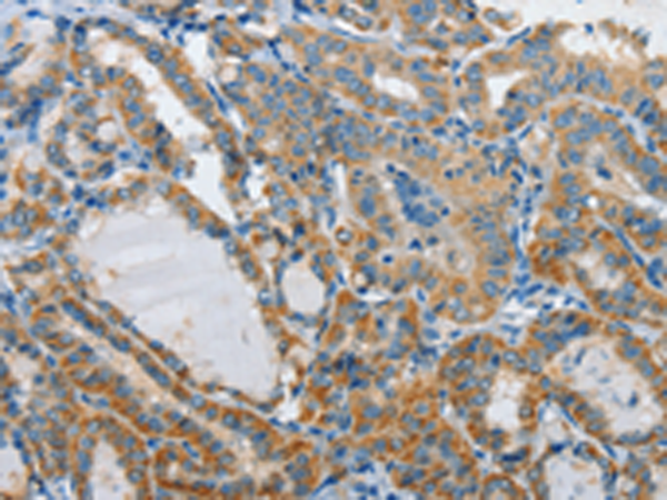 Rabbit Polyclonal Antibody to GZMB