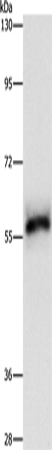Rabbit Polyclonal Antibody to HCK