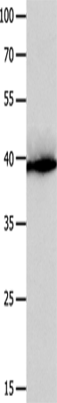 Rabbit Polyclonal Antibody to CFHR1