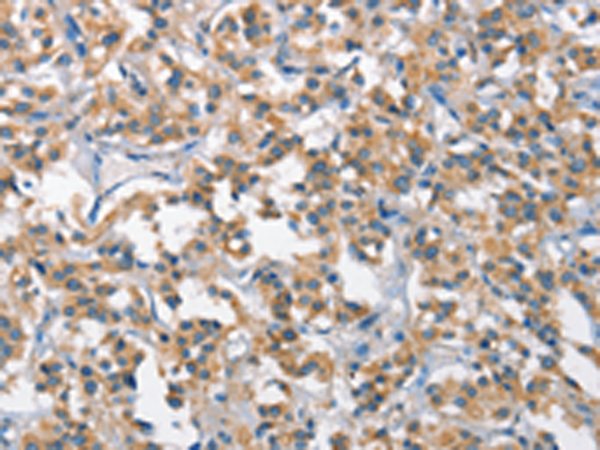 Rabbit Polyclonal Antibody to SCARB1