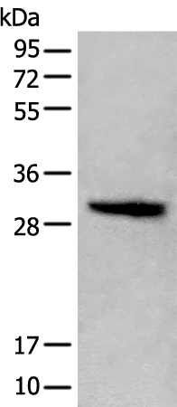 Rabbit Polyclonal Antibody to H1-2