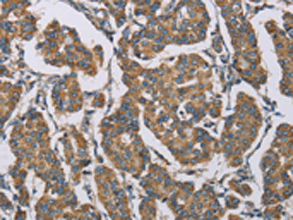Rabbit Polyclonal Antibody to HDAC6
