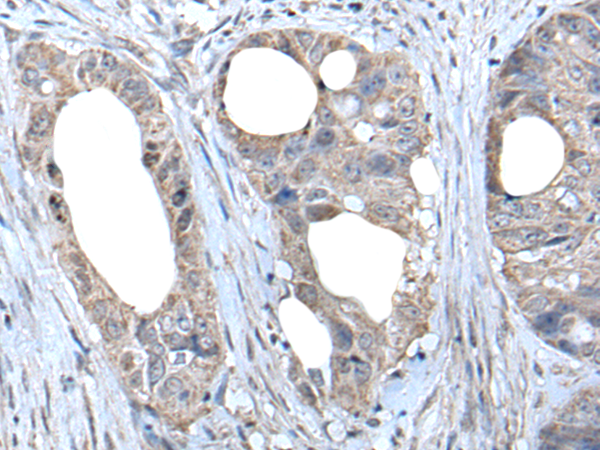 Rabbit Polyclonal Antibody to HDAC10