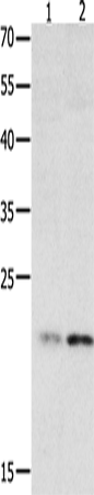 Rabbit Polyclonal Antibody to HMGB4