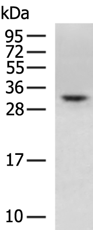 Rabbit Polyclonal Antibody to HOXB1