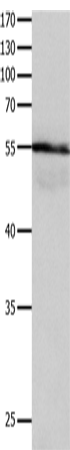 Rabbit Polyclonal Antibody to HP