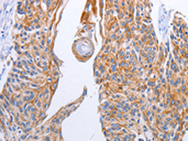 Rabbit Polyclonal Antibody to LIPE