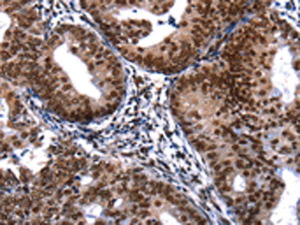 Rabbit Polyclonal Antibody to DFFA