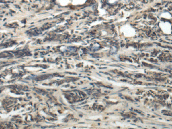 Rabbit Polyclonal Antibody to ICOS