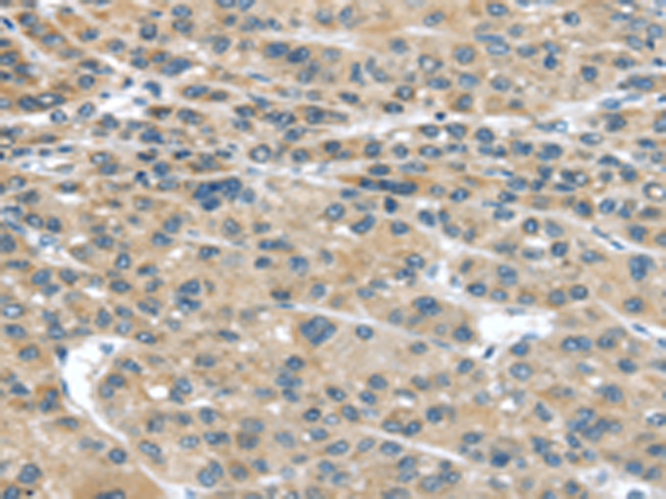 Rabbit Polyclonal Antibody to IGFBP4