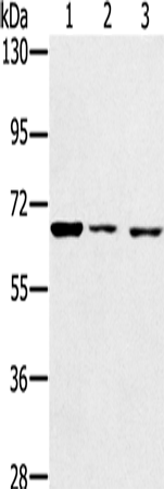 Rabbit Polyclonal Antibody to IGF2BP3