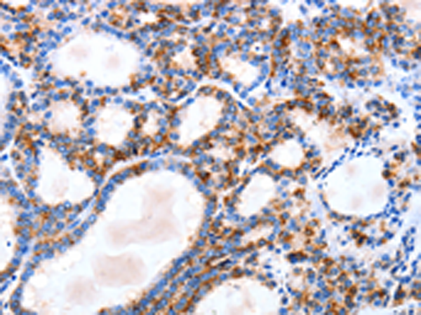 Rabbit Polyclonal Antibody to IGSF6