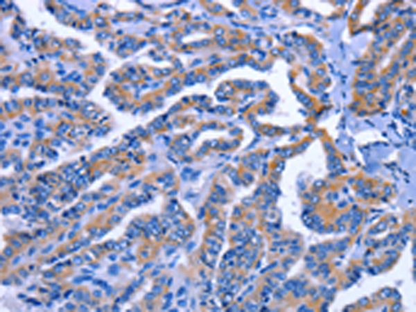 Rabbit Polyclonal Antibody to IGSF10
