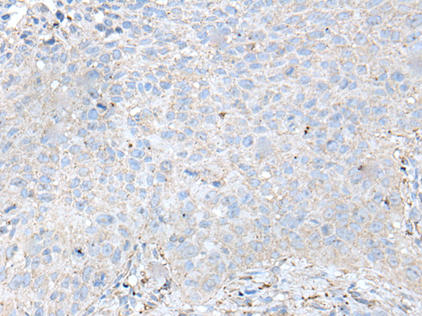 Rabbit Polyclonal Antibody to IL20