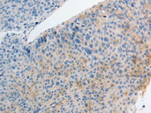 Rabbit Polyclonal Antibody to IL27