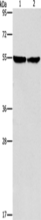 Rabbit Polyclonal Antibody to ILK