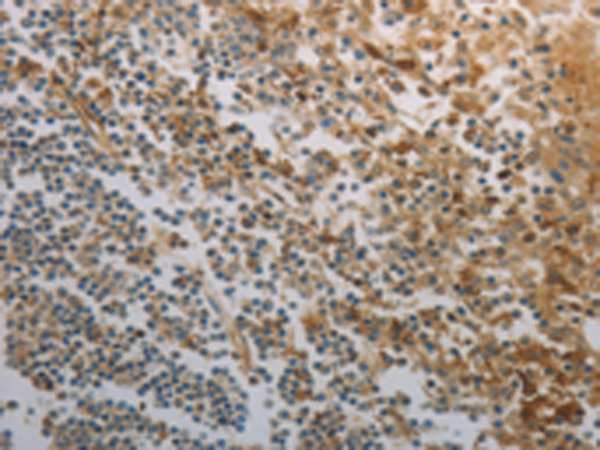 Rabbit Polyclonal Antibody to INHA